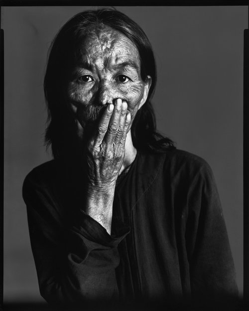 Richard Avedon-Napalm victim, Saigon, South Vietnam, April 29, 1971 Robert Doisneau-Mademoiselle Anita, cabaret « La Boule Rouge », rue de Lappe, Paris,1951.jpg